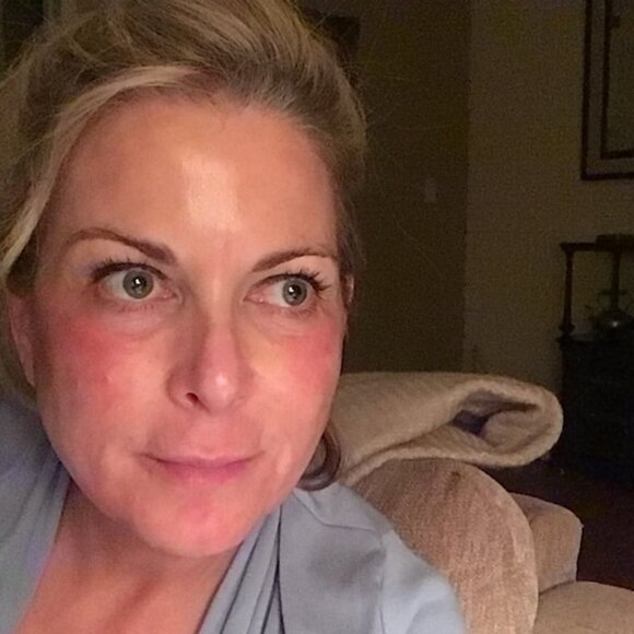 Vegan Lactic Acid peel 50% Melasma Hyperpigmentation Acne Scars Anti Aging etc - Picture 12 of 12